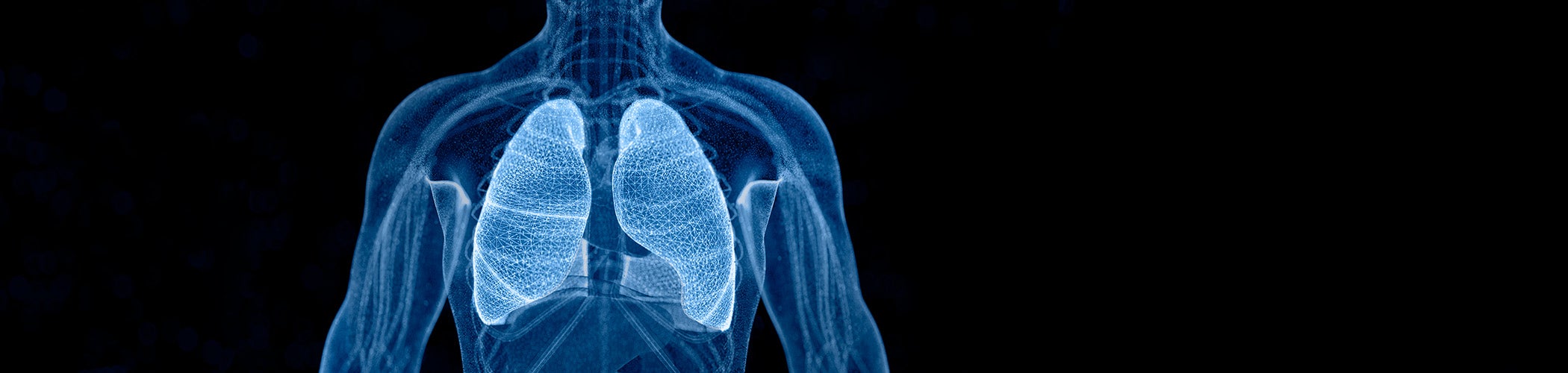 Digital x-ray of a man's torso